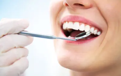 How Do I Know If I Need A Dental Filling?