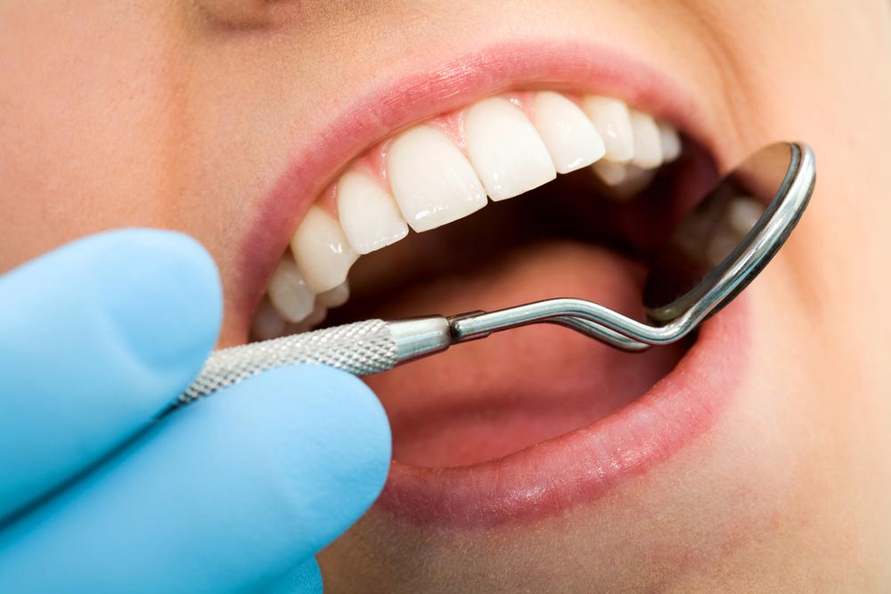 Can You Eat After Getting A Cavity Filled? Everything You Need To Know