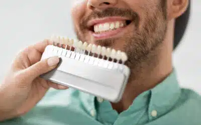 5 Benefits Of Professional Teeth Whitening Over Store-Bought Kits