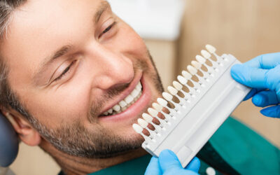 What’s The Difference Between Cosmetic Bonding And Veneers?